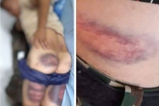 कंगोमा नेपाली सैनिकमाथि अधिकृतको कुटपिट, सेनाले थाल्यो छानविन