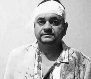गाउँपालिकाको केन्द्र  विवादमा  झडप हुँदा गाउँपालिका अध्यक्ष विष्टसहित १४  घाइते