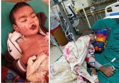 मृत्युसंग लड्दै ९ वर्षीय रोहन, परिवारद्धारा सहयोगको याचना